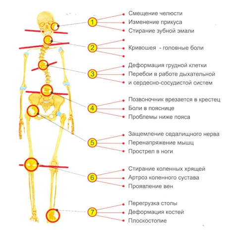 Поясничный отдел позвоночника протрузия лечебная гимнастика Поясничный отдел позвоночника протрузия лечебная гимнастика